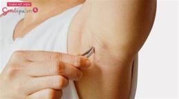 tính năng nổi bật nách bị da gà