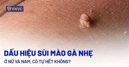 tính năng nổi bật nếu đã bị sùi mào gà mà chích hpv thì sao