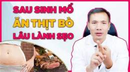 tính năng nổi bật sinh mổ bao lâu ăn được da gà