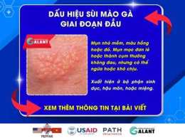 tính năng nổi bật sui mao ga benh vien da