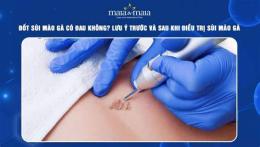 tính năng nổi bật sùi mào gà đã đốt có lây không