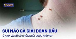 tính năng nổi bật sùi mào gà mọc trên da đầu