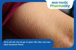 tính năng nổi bật tay nổi mẩn như da gà