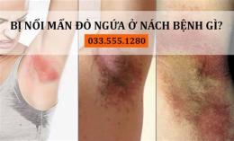 tính năng nổi bật trị nách da gà