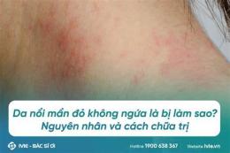 tính năng nổi bật vì sao không nên an da gà