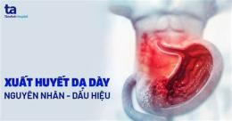 tính năng nổi bật xuất huyết dạ dày tuyến ở gà