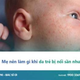 trẻ sốt nổi da gà có nên đắp chăn