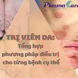 trị da gà