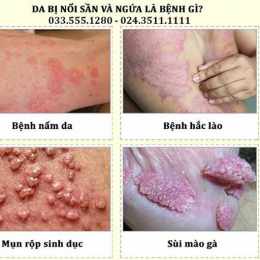 vùng da có bị sần sùi như da gà